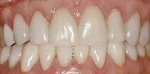 dental images 28546